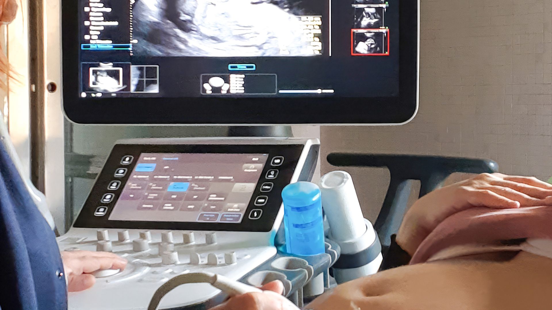 Are Private Baby Scan Clinics Putting Lives At Risk? l Blog